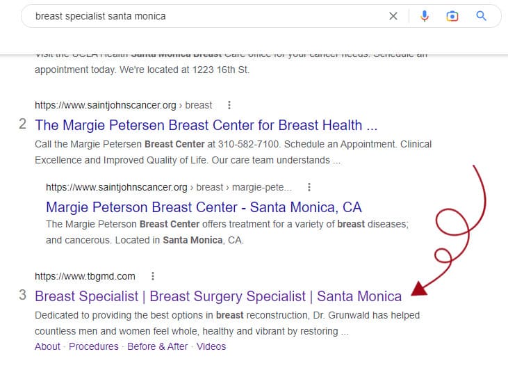 SEO-organic-position-Breast-Specialist-Santa-Monica